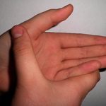 Болит большой палец на руке: причины, диагностика и лечение