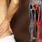 Боли в пояснице отдающие в ногу (левую и правую): причины и лечение