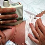 УЗИ тазобедренных суставов у новорожденных — норма, проведение и расшифровка