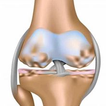 Дегенеративные изменения менисков коленного сустава: диагностика и лечение