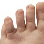 Перелом пальца на ноге: симптомы и лечение (с фото)