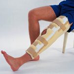 Сколько в среднем заживает разрыв связок коленного сустава