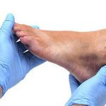 Растяжение связок ноги: причины, симптомы, что делать и как лечить