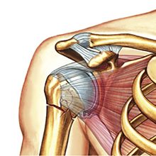 Перелом шейки плеча: причины, симптомы и лечение