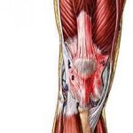 Тендинит коленного сустава: симптомы и методы лечения