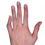 Вывих пальца на руке — симптомы, диагностика и что делать