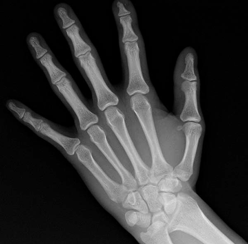 Рентген руки
