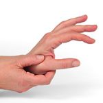 Ризартроз (артроз большого пальца руки): симптомы, диагностика и лечение