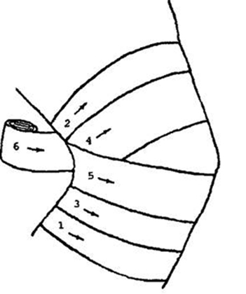 Изображение - Повязка на локтевой коленный сустав shod12