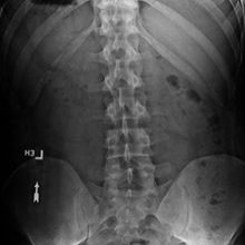 Рентген позвоночника — подготовка и проведение