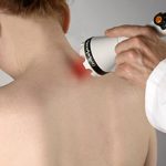 Лазеротерапия при остеохондрозе шейного отдела — показания и применение
